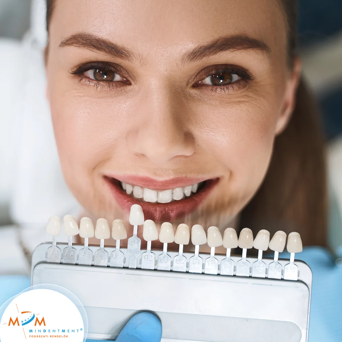 Photoshop-mosoly &eacute;lőben: mikor j&oacute; a h&eacute;j, mikor nem?