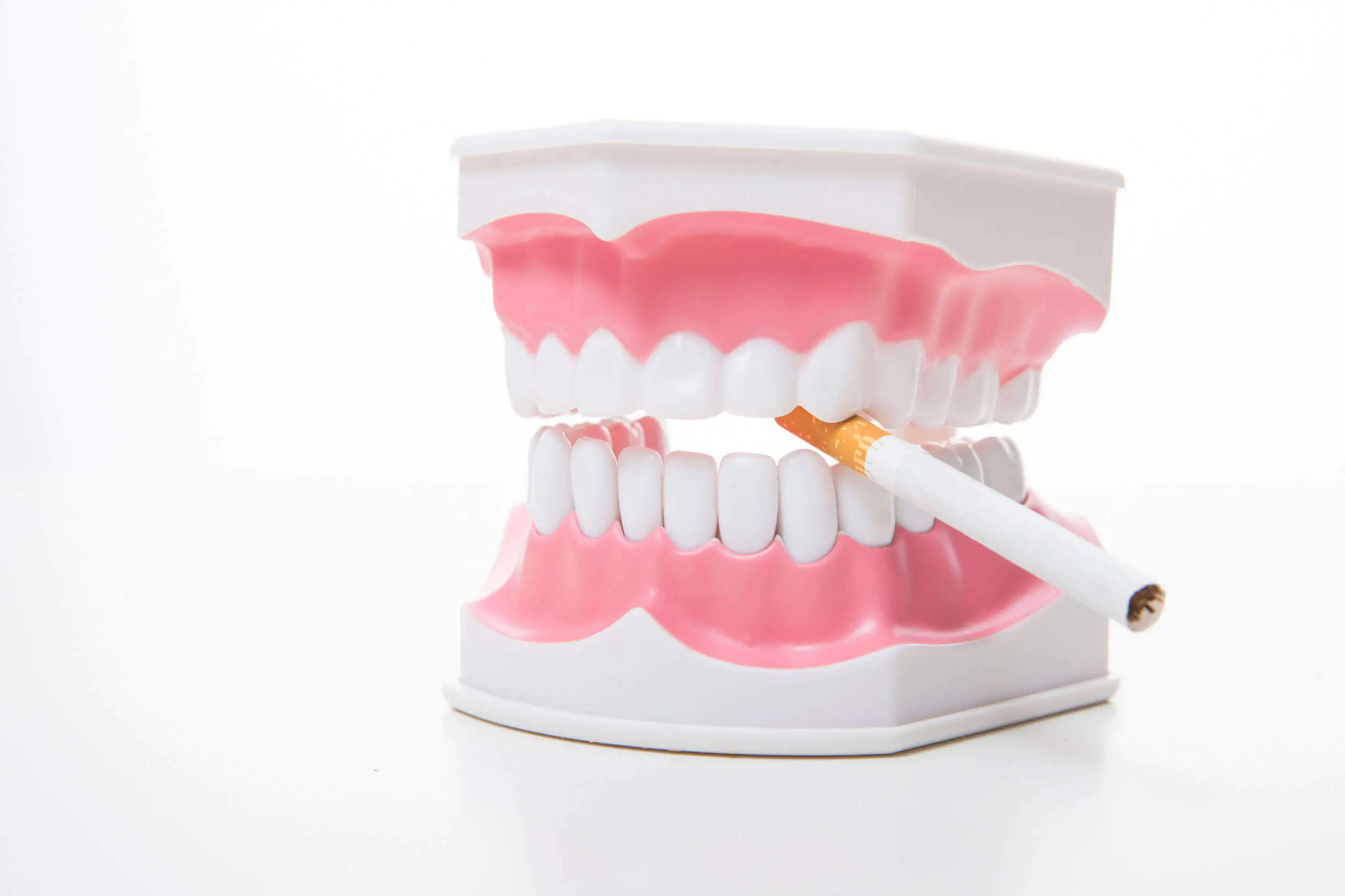 Tudtad? A doh&aacute;nyz&aacute;s nemcsak a fogak eg&eacute;szs&eacute;g&eacute;re van k&aacute;ros hat&aacute;ssal