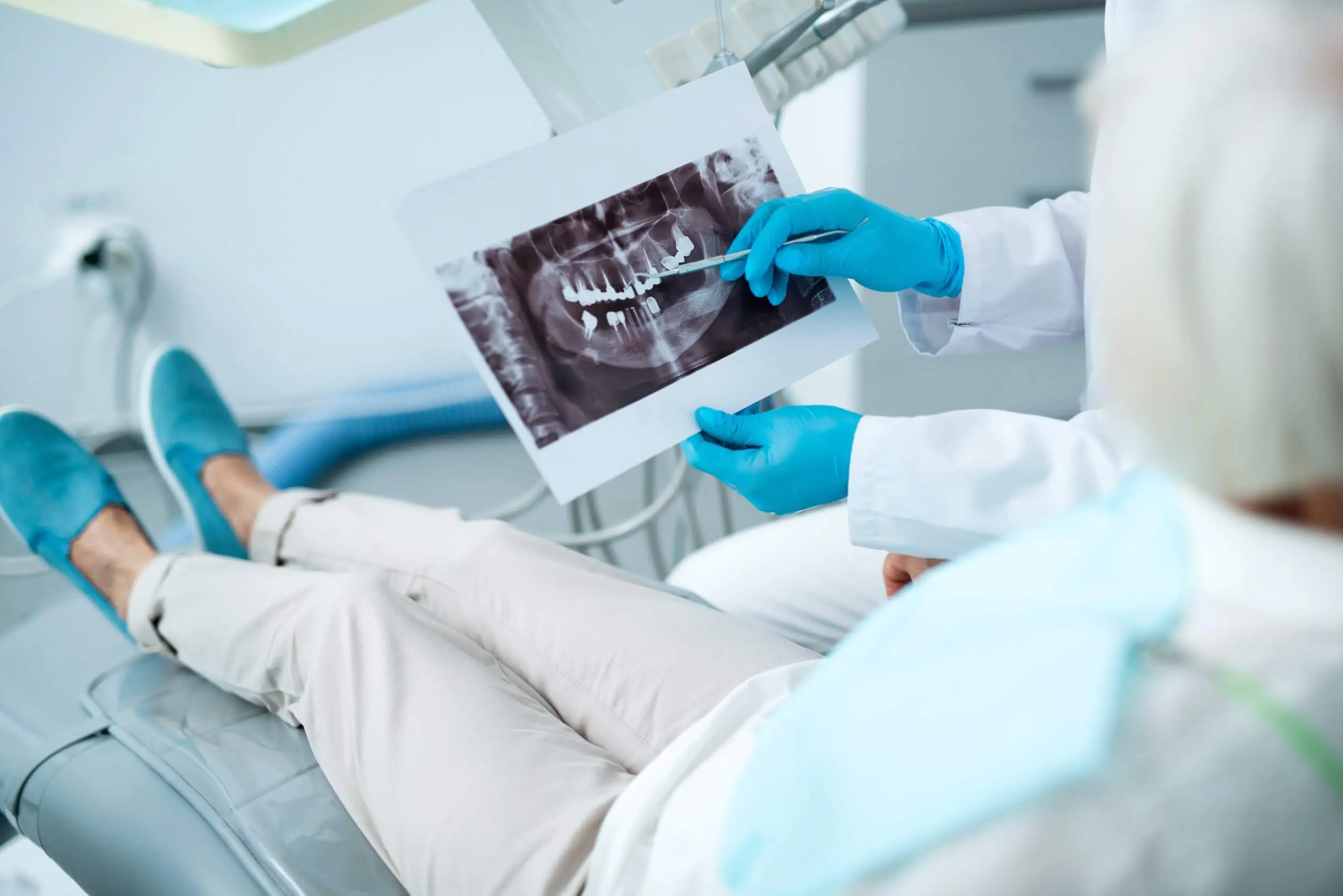Mi a fogászati csontpótlás és milyen esetekben lehet rá szükség?