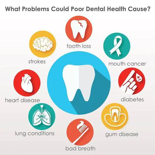 Tudtad, hogy ezek a betegségek mind kapcsolatban állnak a fogaid állapotával?