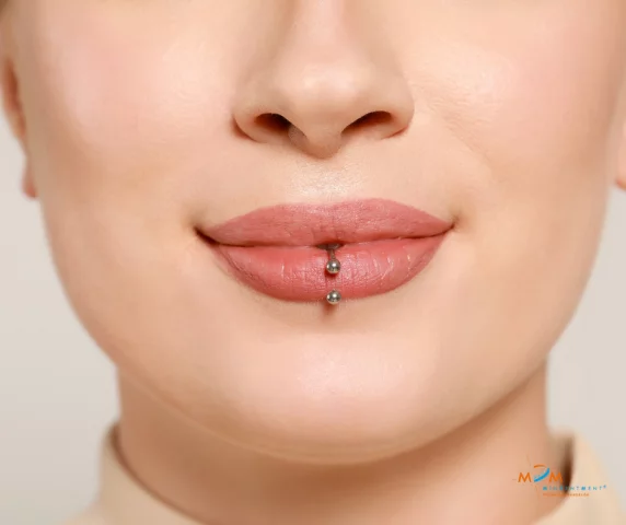 Mire figyeljen, ha nyelv- vagy ajakpiercinget visel?