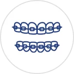 implant