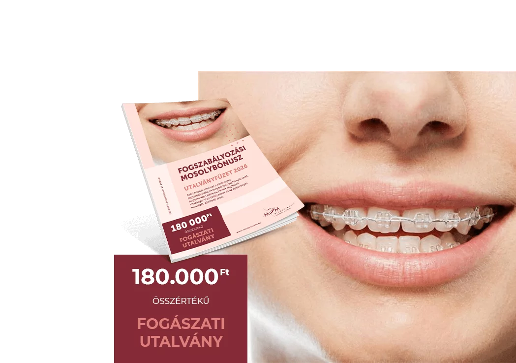 fogszabi sliderk&eacute;p